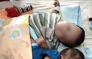 Bayi Kembar Siam Asal Tulungagung Berhasil Dipisahkan, Sayangnya Salah Satu Bayi Meninggal Dunia