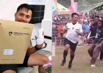 Ridho Bekti Wasit Tarkam Alami Luka di Wajah Hingga Dislokasi Jari, Lapor ke Polsek Bukateja