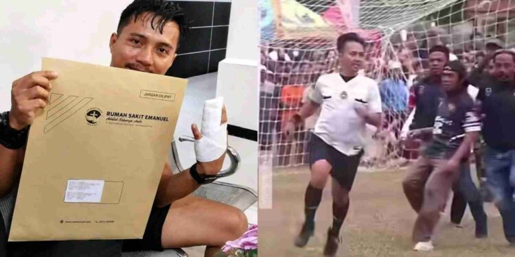 Ridho Bekti Wasit Tarkam Alami Luka di Wajah Hingga Dislokasi Jari, Lapor ke Polsek Bukateja